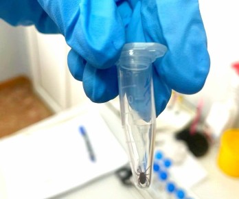 Жертвы укуса: от клещей в Хакасии пострадали 30 человек