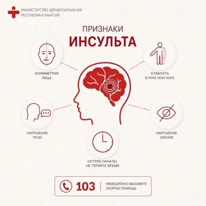 Инсульт: как распознать и что делать?