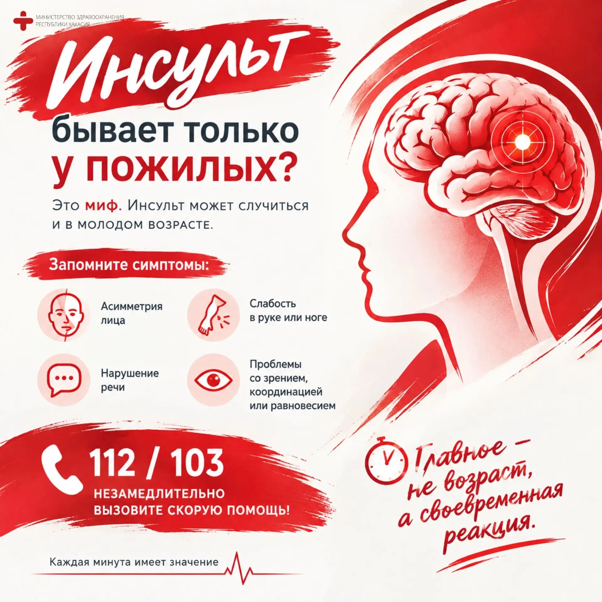 Инсульт бывает только у пожилых? Разрушаем опасный миф